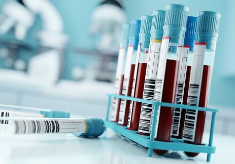 Blood samples and test results in a clinical medical laboratory. 3D illustration