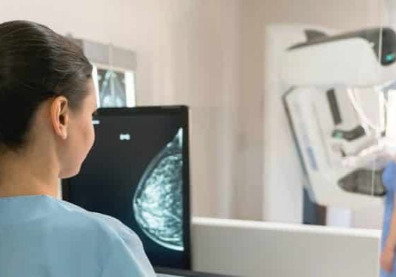Mammogram (For Women)